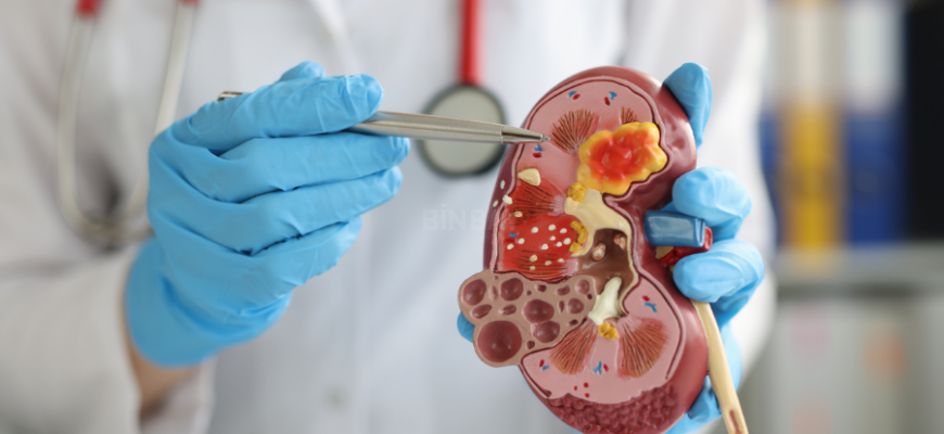 böbrek kanseri nedir